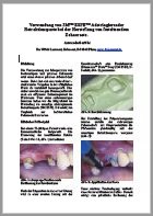 Test adstringierende Retraktionspaste