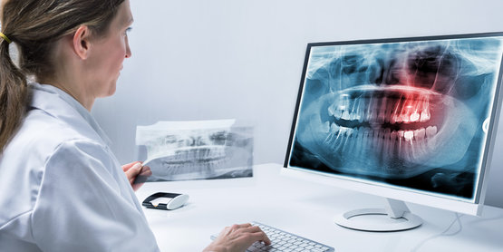Röntgengeräte für Zahnärzte